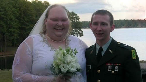زشت ترین عروس دنیا تبدیل به زنی جذاب شد (عکس )
