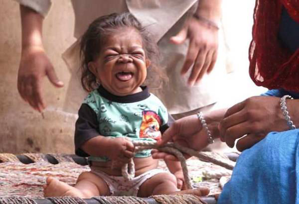 مردی هندی با قد و قواره نوزاد چند ماهه (عکس)