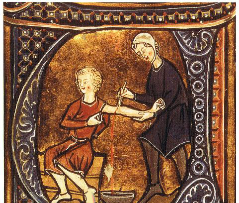 درمان های غیر قابل باور در قرون وسطی (عکس)