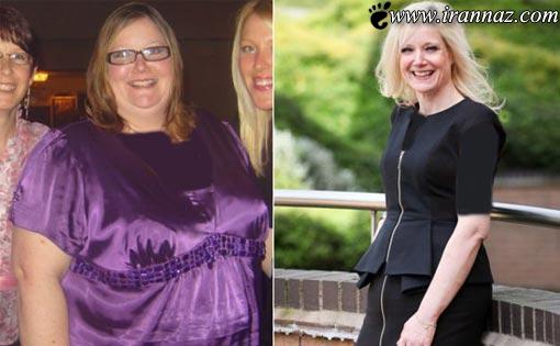 چهره و اندام زنی جوان پس از کاهش وزن 100 کیلویی!