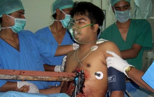10 معجزه باور نکردنی از دنیای پزشکی+تصاویر / www.irannaz.com