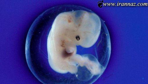 عکس های جنجالی از کودک به دنیا آمده در کیسه آب عکس های جنجالی از کودک به دنیا آمده در کیسه آب
