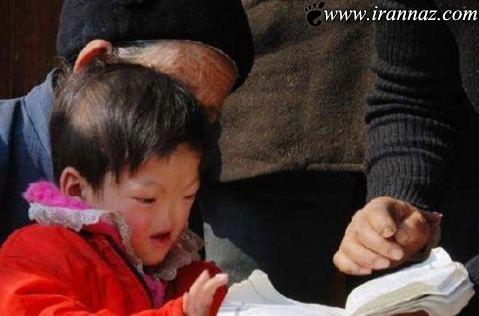 عکس های بسیار عجیب از کودکی که فاقد بینی است