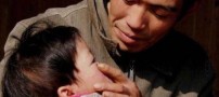 عکس های بسیار عجیب از کودکی که فاقد بینی است