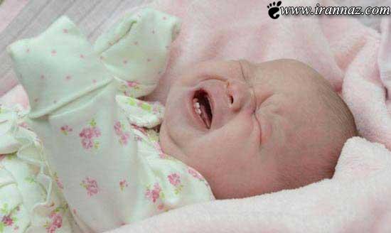 نوزادی که هنگام تولد دارای دو دندان بود (عکس)