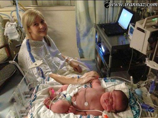 به دنیا آمدن این نوزاد همه را متعجب کرد (عکس)