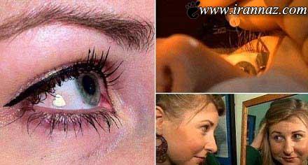 کاشت باورنکردنی جواهر در چشم (عکس)