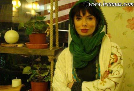چهره این بازیگر زن معروف ایرانی بعد از عمل جراحی