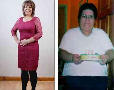 این خانم 40 ساله نمیخواست چاق باشد!! (عکس)