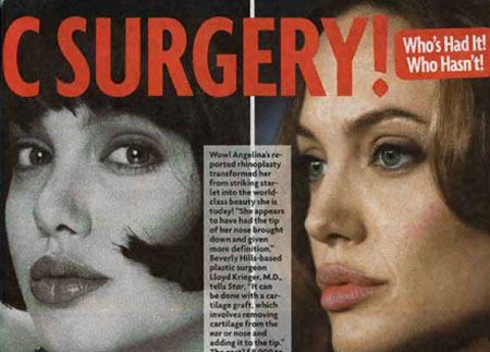 آیا آنجلینا جولی جراحی زیبایی انجام داده؟(عکس)