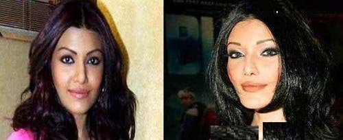 چهره قبل و بعد از عمل ستارگان بالیوود (عکس)