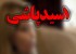 عمل جراحی دختر قربانی اسید پاشی