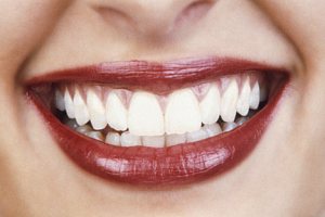 راه های جلوگیری از پوسیدگی دندان ها