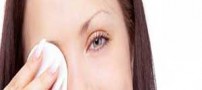 این بیماری در اثر پاک نکردن آرایش چشم ها به وجود می آید