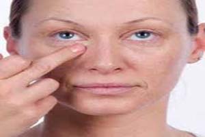 ویتامینه های موثر برای از بین بردن چروک های دور چشم