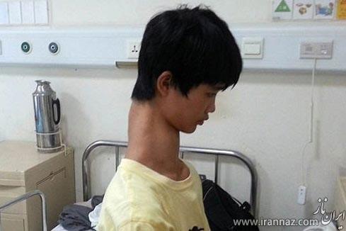 زندگی دردناک پسری با گردنی بلند! (عکس) 
