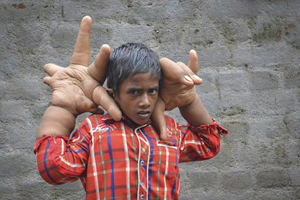 پسر بچه هندی با دست های باورنکردنی! (عکس)