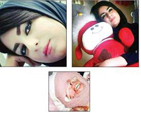 ماجرای اسیدپاشی به صورت دختر مورد علاقه (عکس) ماجرای اسیدپاشی به صورت دختر مورد علاقه (عکس)