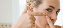خوراکی هایی که در صورت آکنه ایجاد می کنند