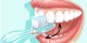 توصیه های پزشکی برای درست مسواک زدن