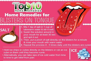 10 راه حل برای درمان تاول روی زبان