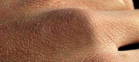 توصیه هایی برای جلوگیری از خشکی پوست در پاییز