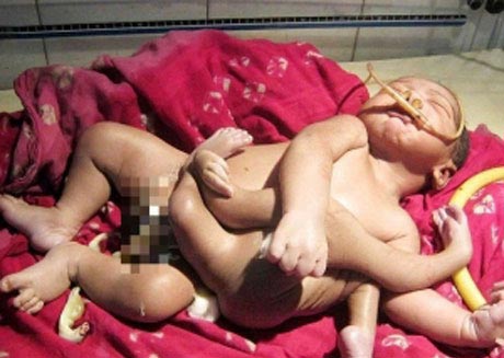 عقیده عجیب هندوها برای دیدن نوزاد هشت دست و پا (عکس)