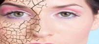 چگونه از خشکی پوست در سرما جلوگیری کنیم؟