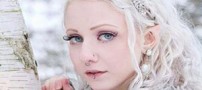 جراحی گوش این دختر برای شبیه شدن به گوش گرگ (عکس)