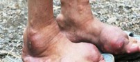 بیماری عجیب در میان افراد روستایی در چین (عکس)