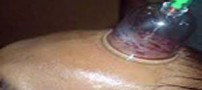 تأثیر مطلوب حجامت در خلق و خوی فرد