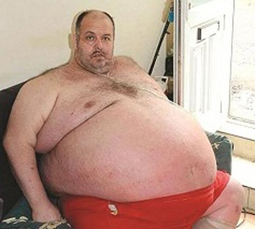 این مرد از چاقی بیش از حد رنج می برد (عکس)