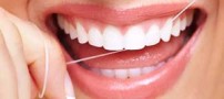 نخ دندان استفاده کنیم یا مسواک بین دندانی؟