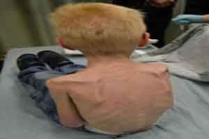 شکنجه دردناک کودک 5 ساله توسط نامادری (عکس)