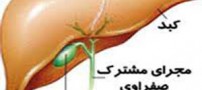 مهمترین عامل ایجاد سنگ صفرا چیست؟