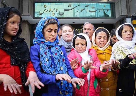چهره های دردناک دختران سوخته شین آبادی و اعتراض در تهران