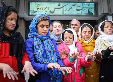 چهره های دردناک دختران سوخته شین آبادی و اعتراض در تهران