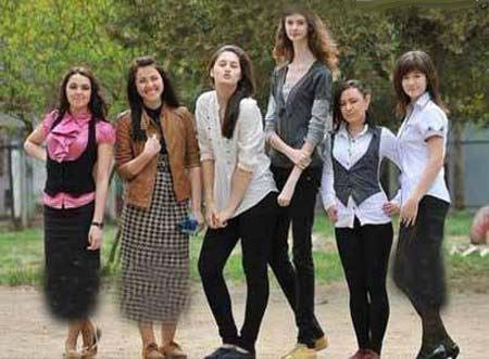 دختری با عضو متفاوت اندامش، ترین جهان شد (عکس)