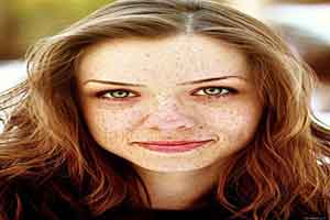 راه های جلوگیری از ایجاد کک و مک