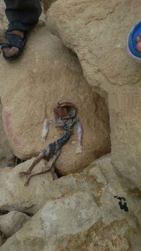 جنجال جسد تجزیه شده جنین انسان در ساحل بندرعباس (عکس)