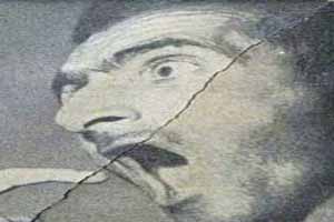 دندانهای مصنوعی مردی را در تهران از دهانش دزدیدند ! عکس