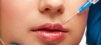 خطرات تزریق ژل به لب