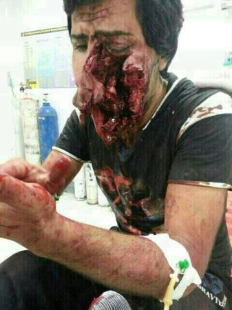 حمله وحشتناک خرس به جوان خوزستانی در ایذه (۱۶+)