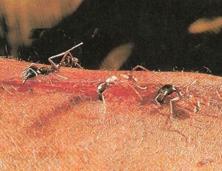 مورچه های حیرت انگیز که جراحی می کنند!! عکس