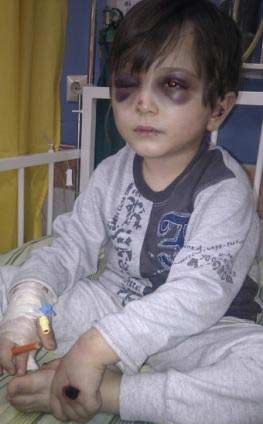 کودک آزاری دیگر در تهران عکس و جزئیات