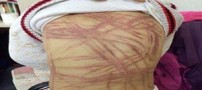 آزار و اذیت وحشتناک این پسر به مدت 3 سال! (عکس)