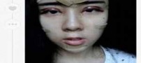 چهره عجیب دختر 15 ساله برای باربی شدن (عکس)