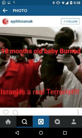 (16+) نوزادی که زنده زنده سوزانده شد (عکس)