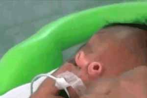 فرشته ای با دو بینی عجیب متولد شد (عکس)