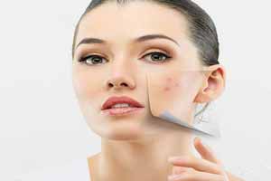 روش های ماهرانه برای رفع جای جوش